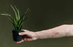 Fight the stigma during Psoriasis Action Month