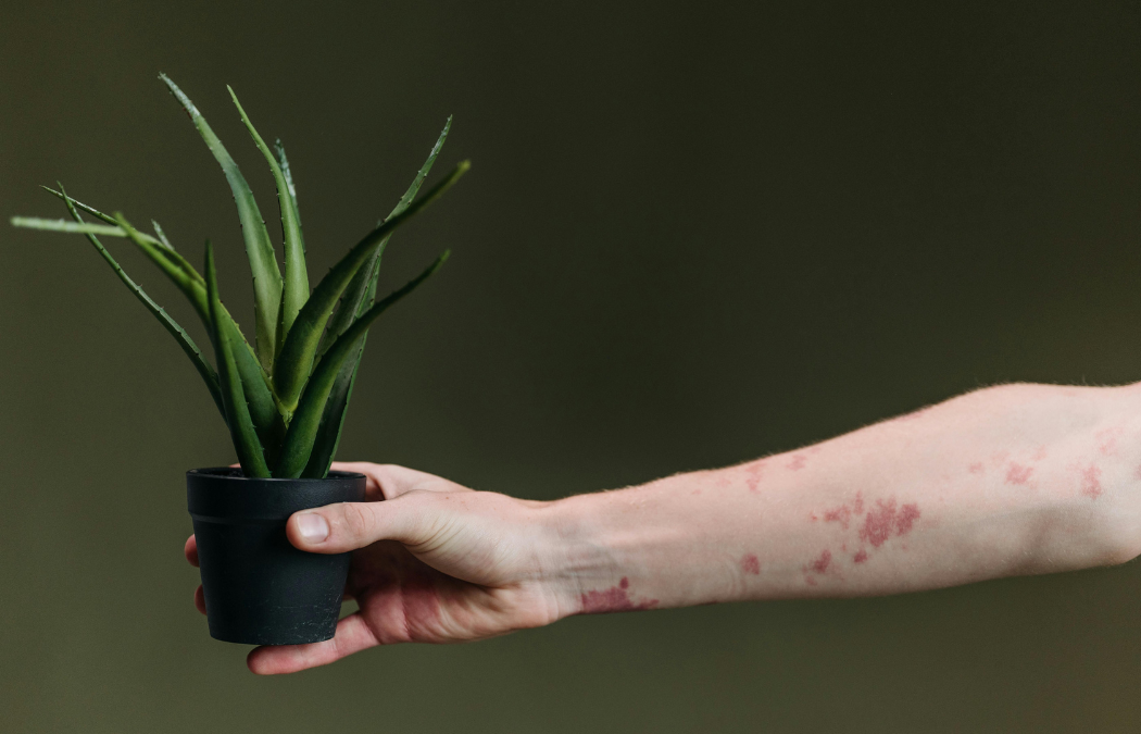 Fight the stigma during Psoriasis Action Month